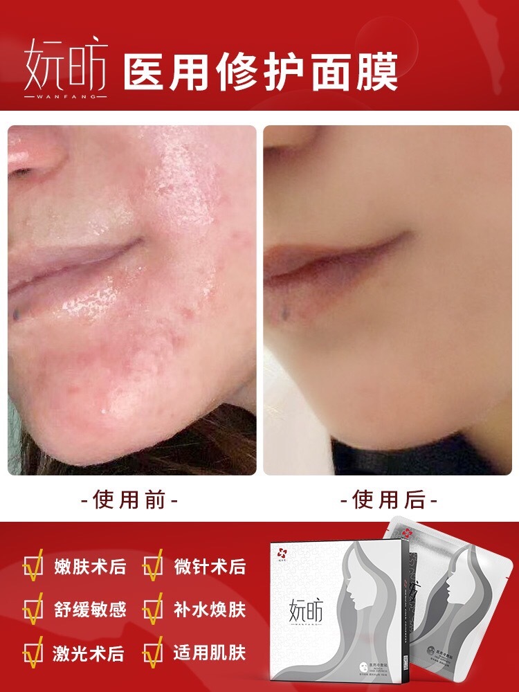 陈锋-广东省·汕头市·龙湖区--妧昉医用面膜，对于过敏性肌肤，修复肌肤多重问题的面膜。市场价格优势强，品牌保证，证件齐全。