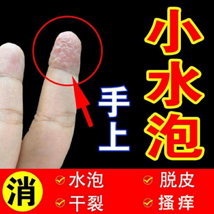 momo-山西省·太原市·小店区--请各位网红达人,根据我们的优乐臣(主要用于皮治疗皮肤病,手脚水泡脱皮瘙痒干裂,产品赠送),创作相关的短视频,短视频要求如下:说明用途,讲清购买方式,网购。创作好之后,请将短视频发布到抖音、快手等平台,