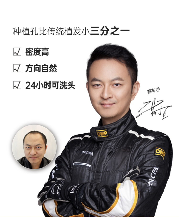 张鑫-北京市·北京市·海淀区--产品:大麦微针植发
合作模式:100万粉丝以上,(价值3-5万)我帮您免费植发,您帮我宣传
注:粉丝量不够可以合作探店,赠送价值680头皮检测养护套餐,到店体验
执行时间:8-9月份
我们全国35家分